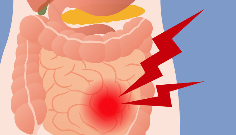 Síndrome do Intestino Irritável